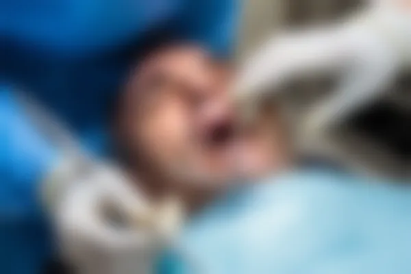 补牙350元一颗，是否算贵？了解补牙费用的合理性与市场行情。