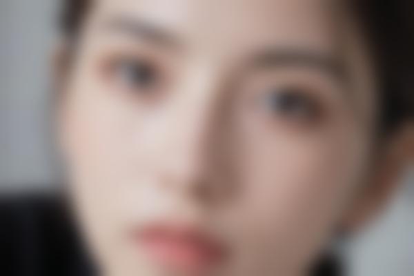 2、魏凌华皮肤管理真实变化肉眼可见