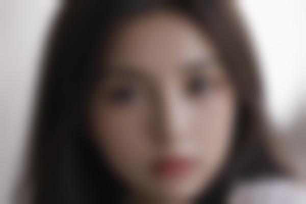 大庆艾尚美颜陈涛医生馒化脸修复技术解析：精细自然，万例0事故记录！