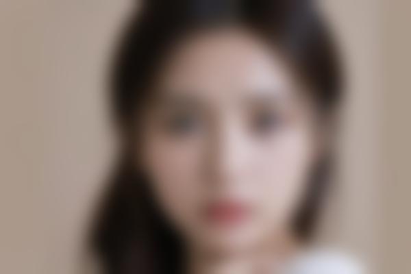 张云林医生面部年轻化修复怎么样？