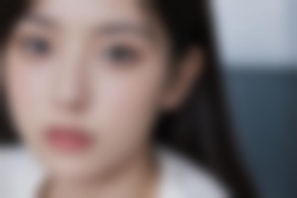 河北邯郸曲胜医生整形修复技术怎么样？曲胜医生眼部鼻部综合改善价格实惠好！