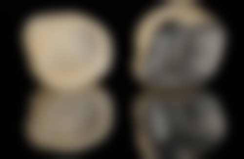 不同美白方式的具体伤害情况