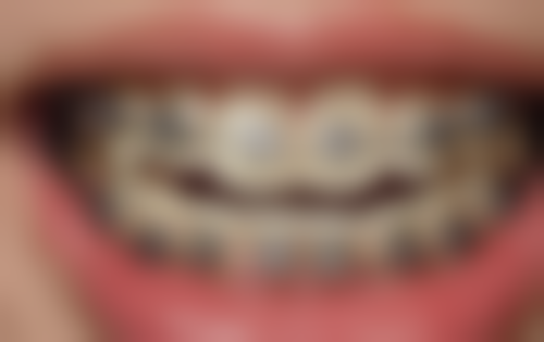 韩国雪白牙科医院硬件设备精良！