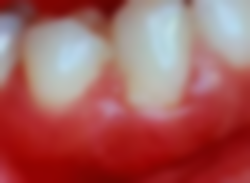 总结——兖州学锋口腔医院怎么样？