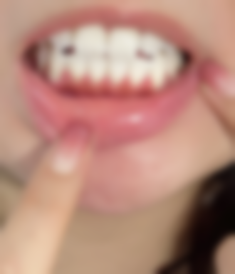 韩国雪白牙科医院电话号码及预约方法