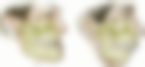 北京齿康口腔(朝阳路门诊)口碑如何？