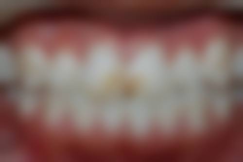 大连全好口腔(马栏子店)医院技术好不好?