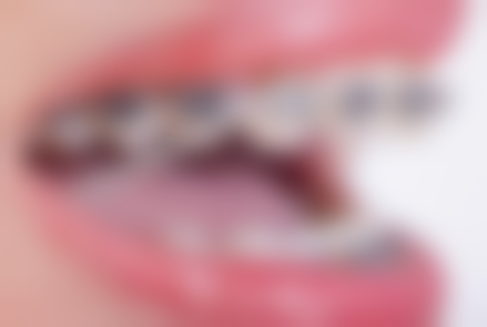 巴中白玉牙科医院(草坝街店)地址