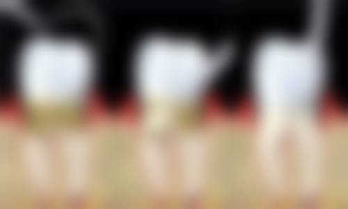 杭州银湖口腔数字化种植矫正中 心（高桥万达广场店）医生简介