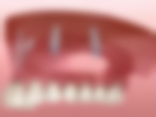 总结——阿拉尔博恩口腔怎么样？