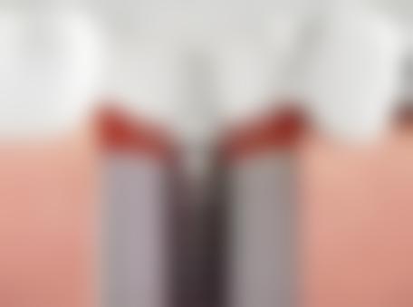 库车市锐珂口腔地址