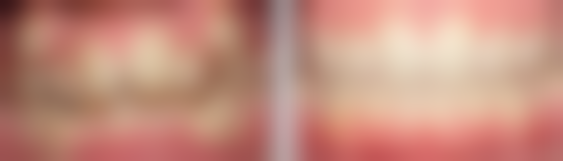 西安欢乐口腔医院口碑如何？