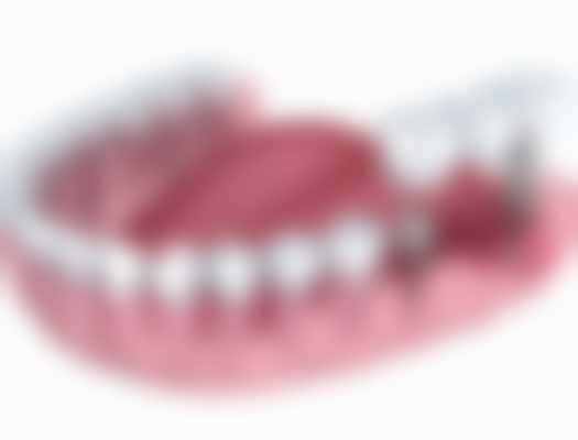 总结——上饶鄱阳泽雅口腔怎么样？