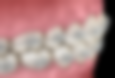 总结——威海澳美口腔门诊部怎么样？