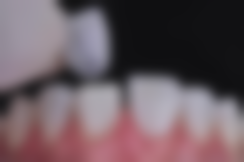 北京劲松口腔(枣营店)蒋相臣医生口碑评价如何？