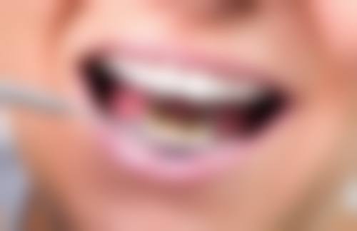 深圳尚德口腔门诊部口碑如何？