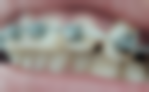 威海曲波口腔电话号码及预约方法