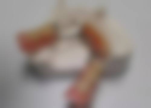 种植牙根烤瓷牙哪种好？从适用人群、价格、耐用性多方面综合对比选