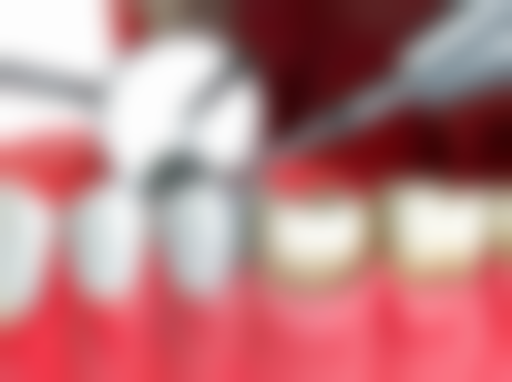 临朐惠康口腔地址