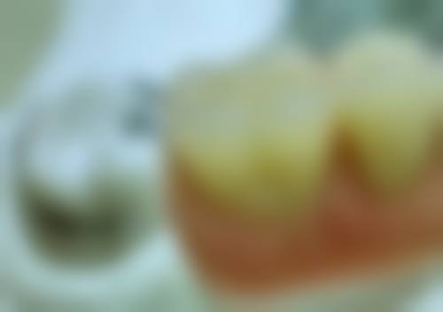 饮品也有牙齿美白功效