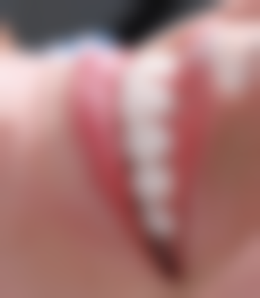 自我矫正的注意事项