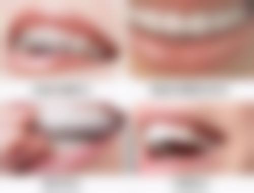 四岁儿童牙齿地包天是怎么引起的