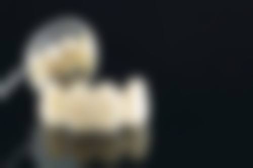 60岁老人种植牙成功实例及经验