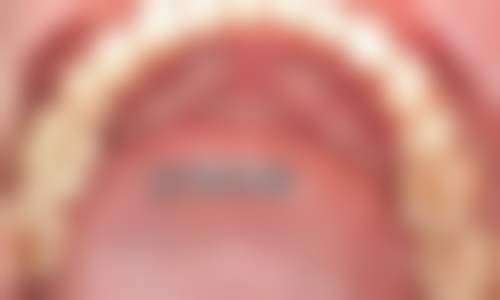 珠海六和口腔醫院（澳門院區）李昊医生口碑评价如何？