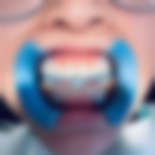 珠海六和口腔醫院（澳門院區）李昊医生技术好不好？