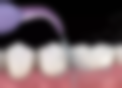 梅州嘉诚口腔门诊地址