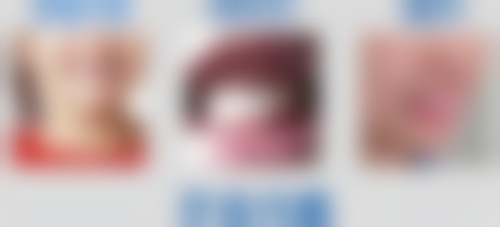 湖南娄底涟源红建口腔医院医院技术好不好?