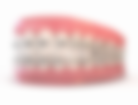 诺贝尔种植体的优势