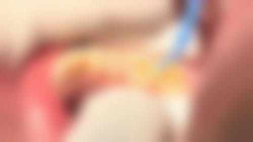 总结——珠海六和口腔醫院(澳門院區)吴志聪医生怎么样?