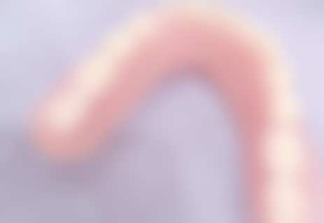 活动义齿修复后的注意事项