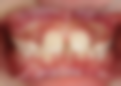 江苏连云港赣榆博泰口腔电话号码及预约方法