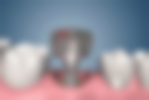 总结——珠海六和口腔醫院(澳門院區)吴志聪医生怎么样?