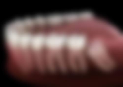 商洛市山阳阮氏口腔诊所口碑如何?