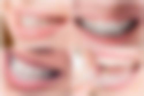 深圳金泰诺齿科(康齿诺口腔)口碑如何?