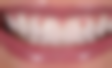 南京江宁琳容口腔诊所口碑如何？