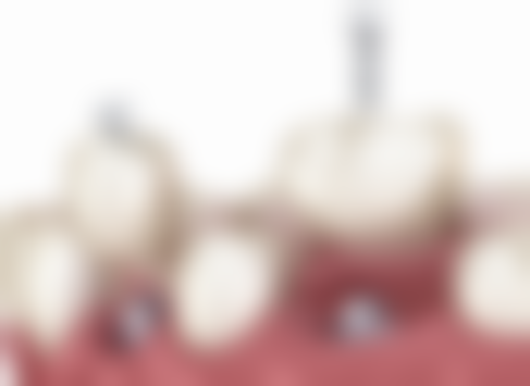 天津南开齐美口腔赵冬玥医生技术好不好？