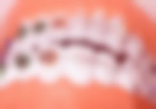 宜宾翠屏微笑口腔口碑如何？