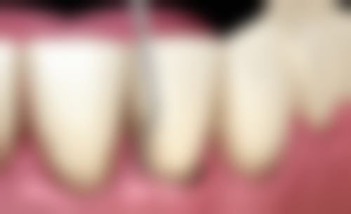 总结——郑州林则口腔门诊部武汉生医生怎么样？