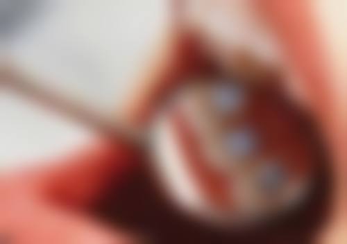 上海马泷齿科(永颜门诊)口碑如何?