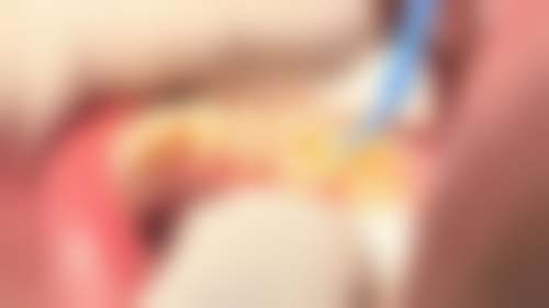 珠海六和口腔醫院（澳門院區）梁展朋医生口碑评价如何？