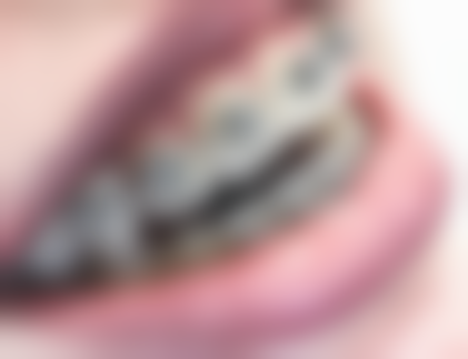 文合口腔口碑如何?