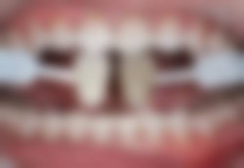 上海东辰口腔医院技术好不好？