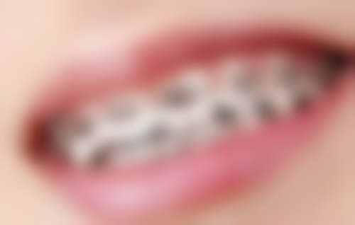 总结——泉州丰泽陈霖口腔怎么样？