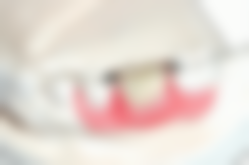 肇庆市亮牙口腔收费标准参考