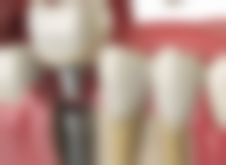 总结——内蒙古乌兰察布陈氏口腔怎么样？