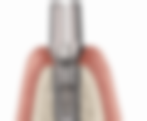 库尔勒崔栗口腔诊所医生简介